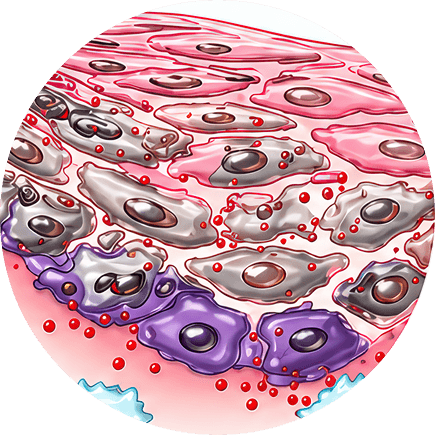 Inflammation
