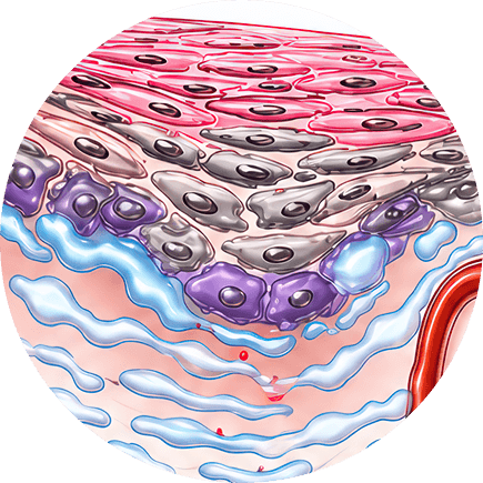 Persistent Focal Edema