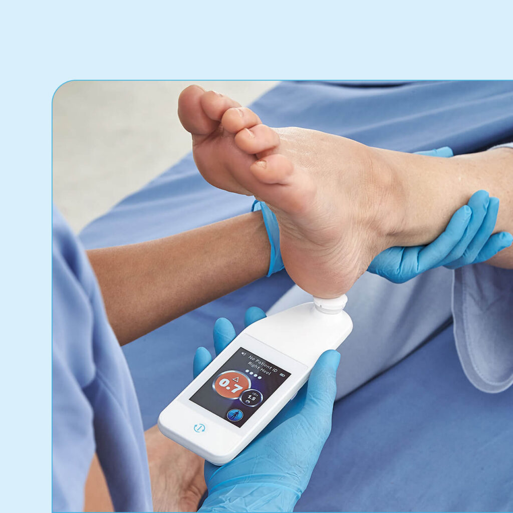 provizio scanner on heel