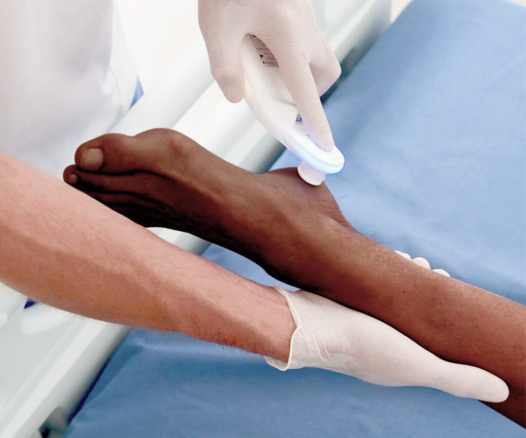 provizio on heel with darker skin tone
